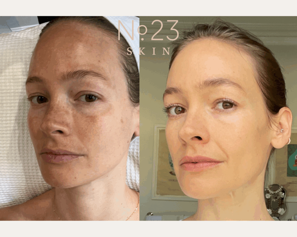 No.23 Skin - THE 2026 GUIDE TO TREATING PIGMENTATION (WITHOUT THE CONFUSION)
